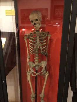 Das Skelett der Theresia Kandl<br />(© wien.kriminalmuseum.at)